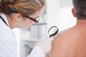 Understanding Medicare Coverage for Skin Cancer