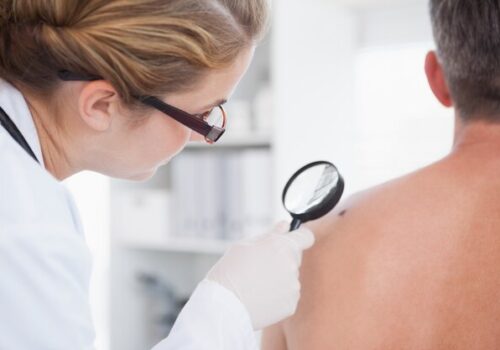 Understanding Medicare Coverage for Skin Cancer